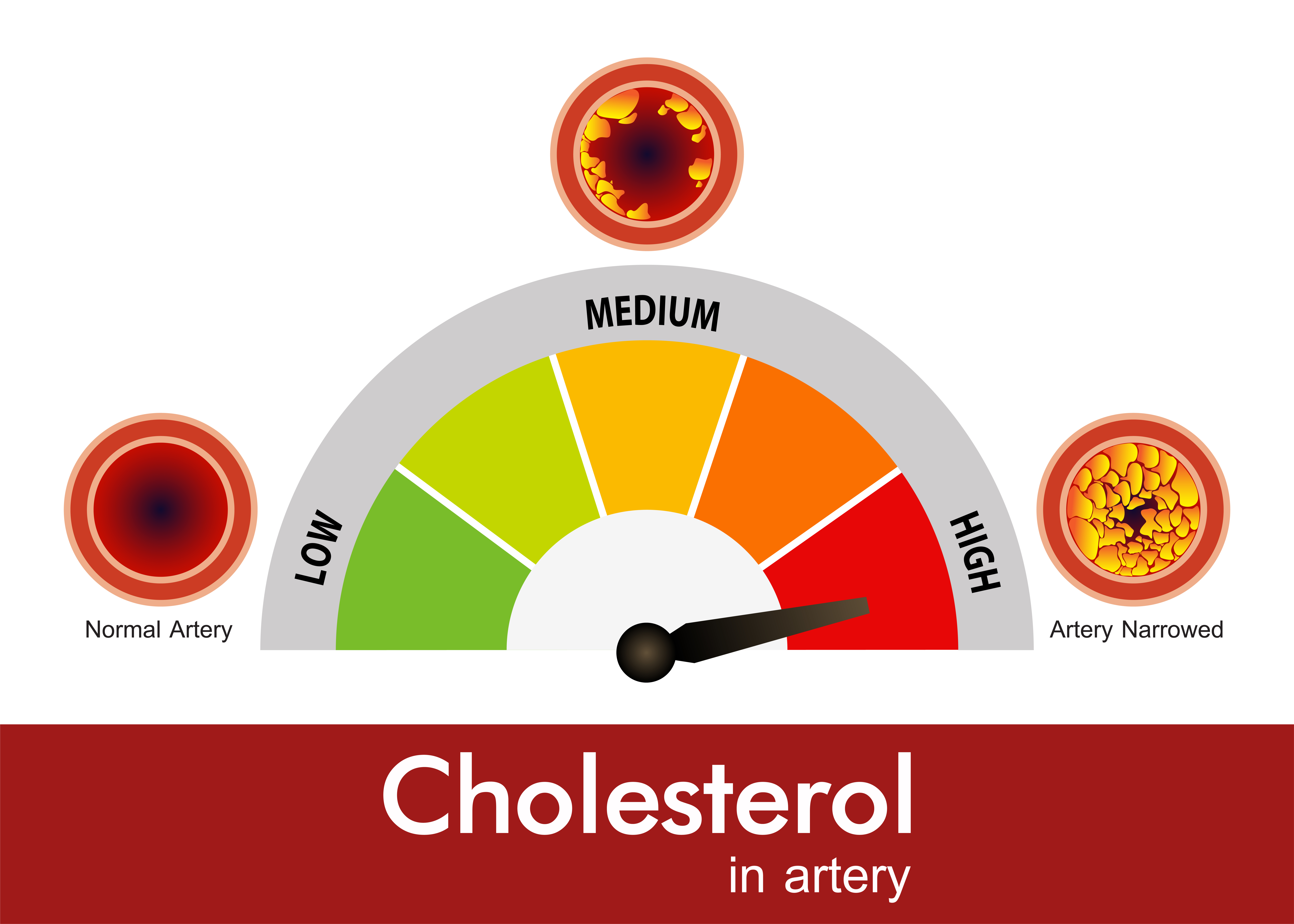 Risks of high cholesterol in men and how to get it under control 