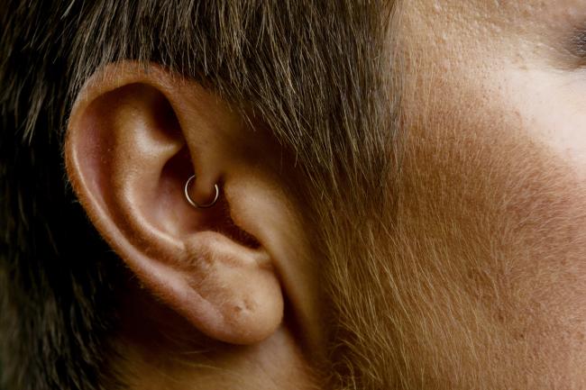 Ask the Doc: Can a daith or tragus piercing help with migraine?